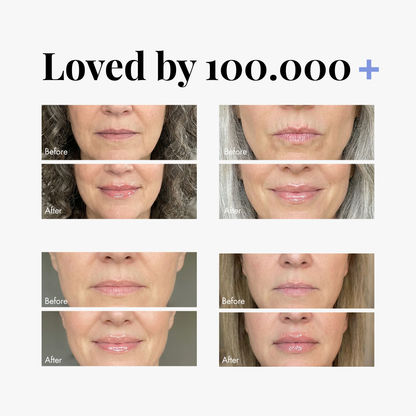 Triple Lip Plumper Bundle