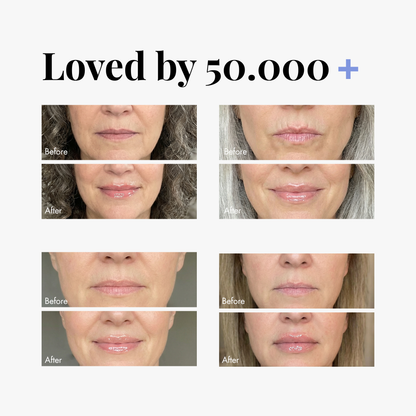 Extreme Lip Plumper